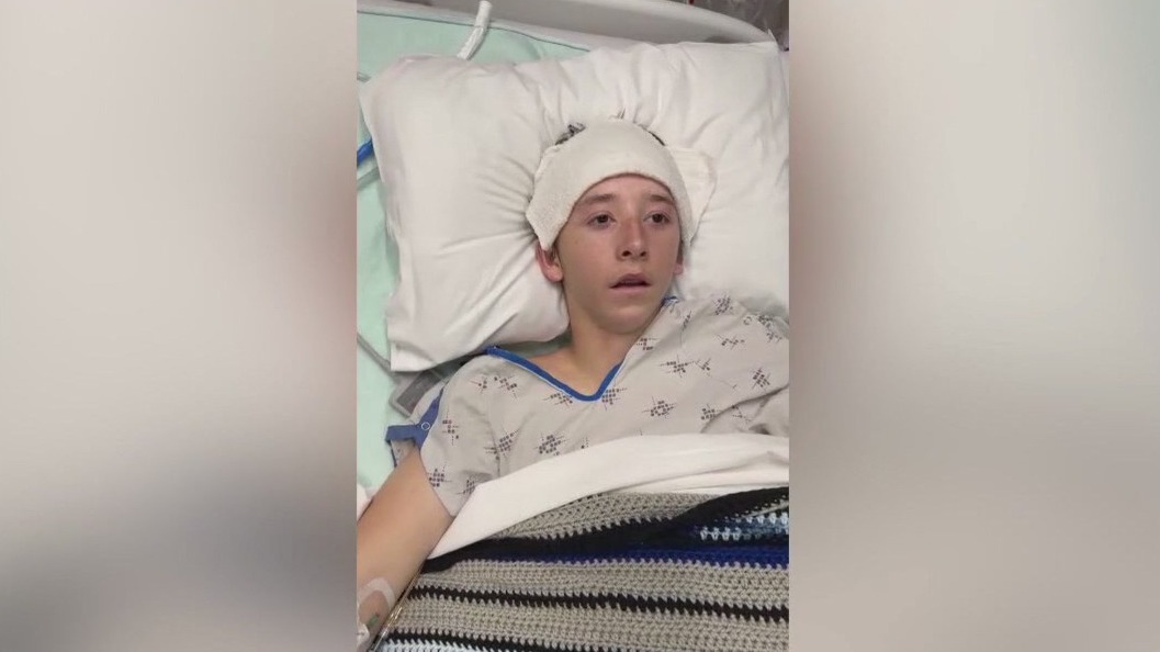 Snowboarding Accident in Napa Leaves Teen with Life-Altering Injuries