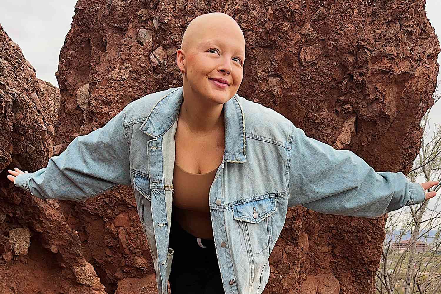 Young Woman Embraces Life After Misdiagnosed Illness Reveals Terminal Cancer