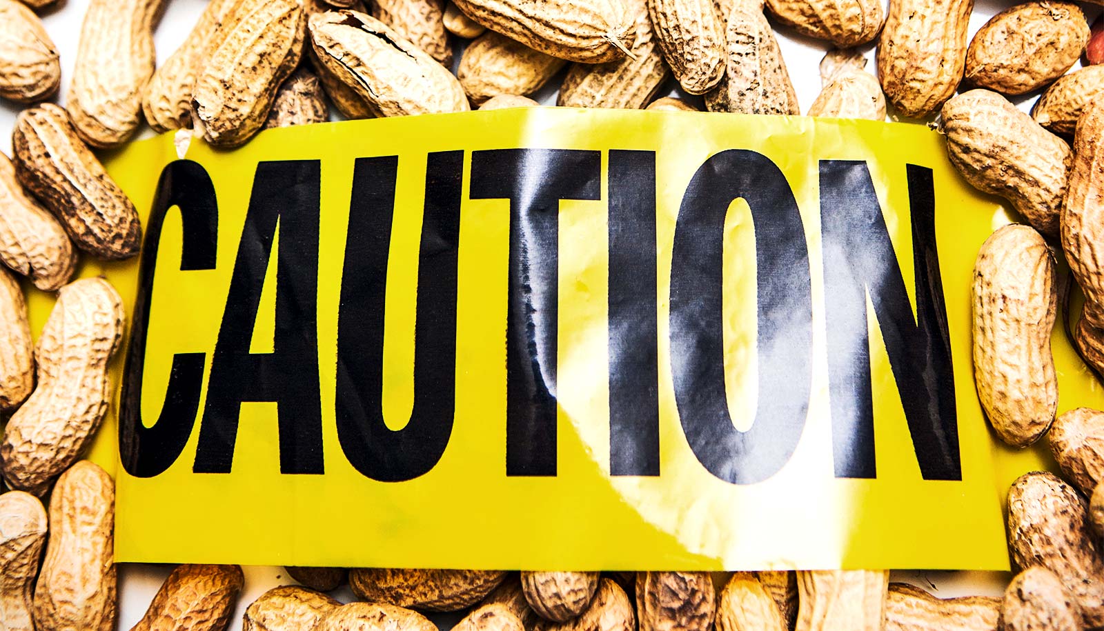 Transforming Allergy Care: The Promising Role of Injectable Omalizumab in Food Allergy Management