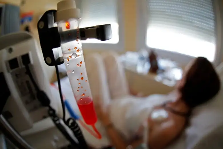 A patient receives chemotherapy treatment for breast cancer in France.