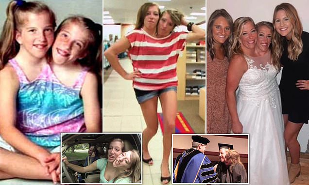 Inside the incredible life of conjoined twins Abby and Brittany Hensel