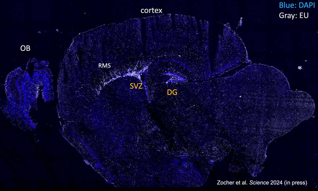 Persistent Presence of Essential Molecules in Nerve Cells Revealed by Latest Study
