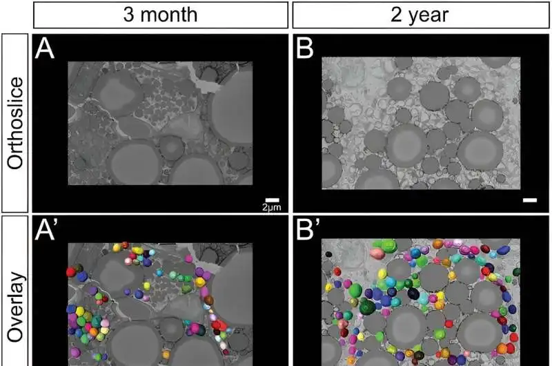 This partial figure from the paper illustrates the steps taken to compare the mitochondria of young and old mice. First, thin tissue slices were imaged with an advanced imaging method called serial block face-scanning electron microscopy. Then, the mitochondria were identified and 3D reconstructions were overlaid on the tissue images. Finally, the 3D reconstructions were analyzed for volume, surface area, and other metrics. Credit: Advanced Biology (2023). DOI: 10.1002/adbi.202300186 Lab maps structure of mitochondria at different life stages