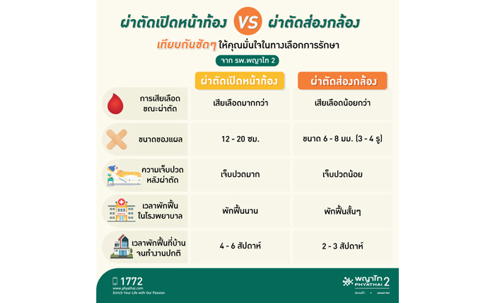 โรงพยาบาลพญาไท 2 ชูเทคโนโลยี นวัตกรรมผ่าตัดผ่านกล้องชั้นสูง แผลเล็ก หายไว