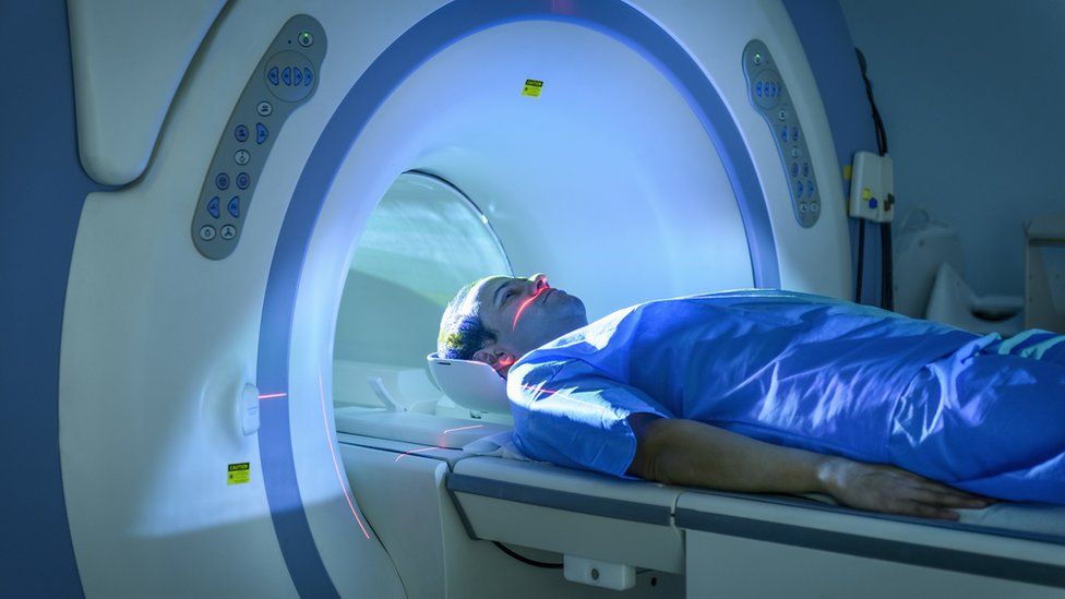 Long Covid: MRI scans reveal new clues to symptoms