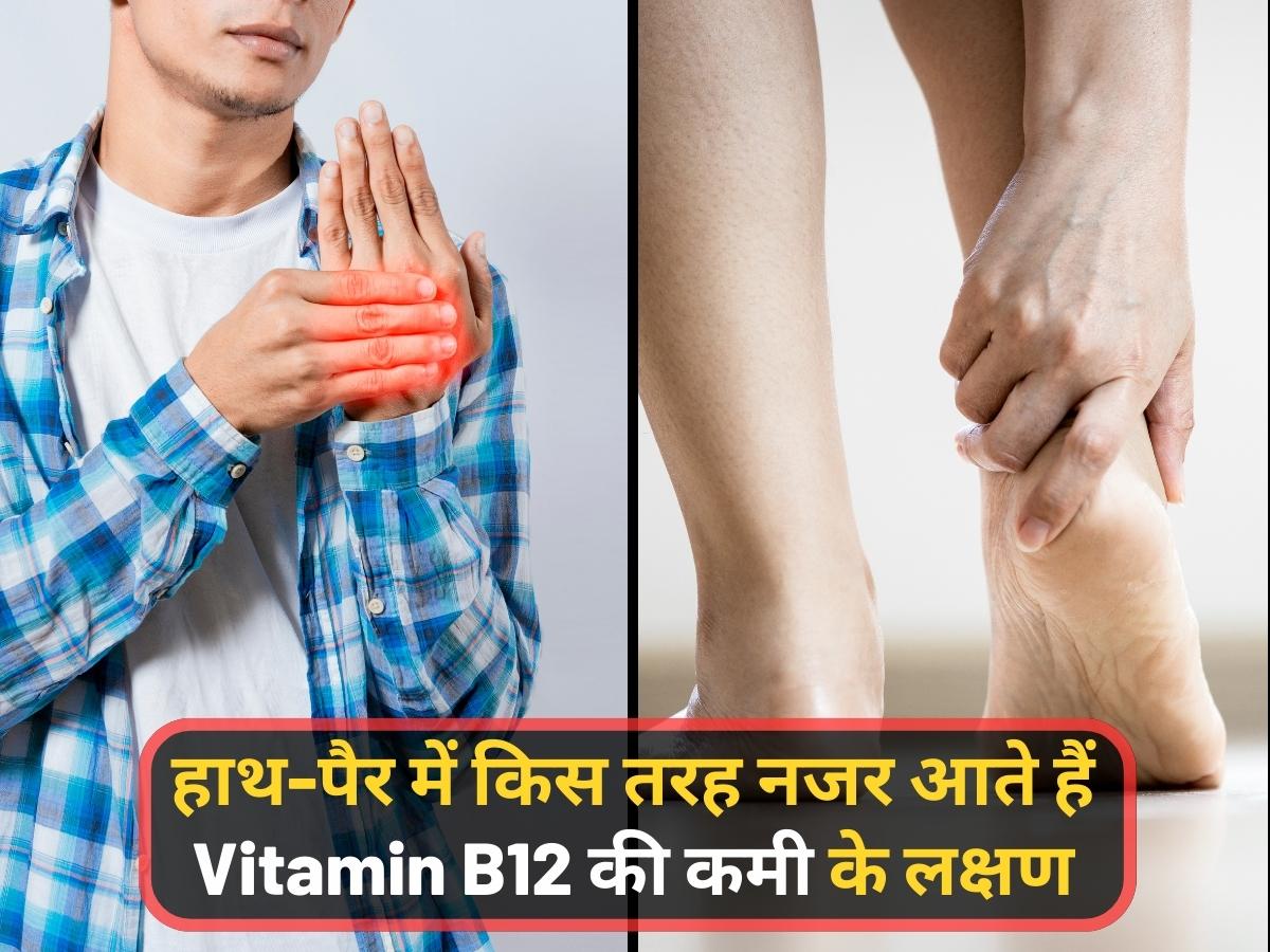 Vitamin B12 Deficiency: विटामिन बी12 की कमी से हाथ-पैर दिखने लगते हैं ऐसे, तुरंत खाना शुरू करें 5 शाकाहारी फूड