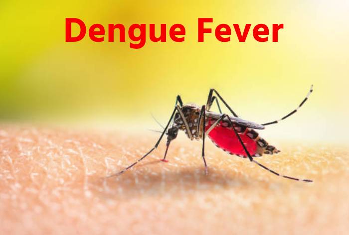 Dengue Fever: जानिए डेंगू के लक्षण और इलाज, 5 फूड जो जल्दी रिकवरी कराएंगे–