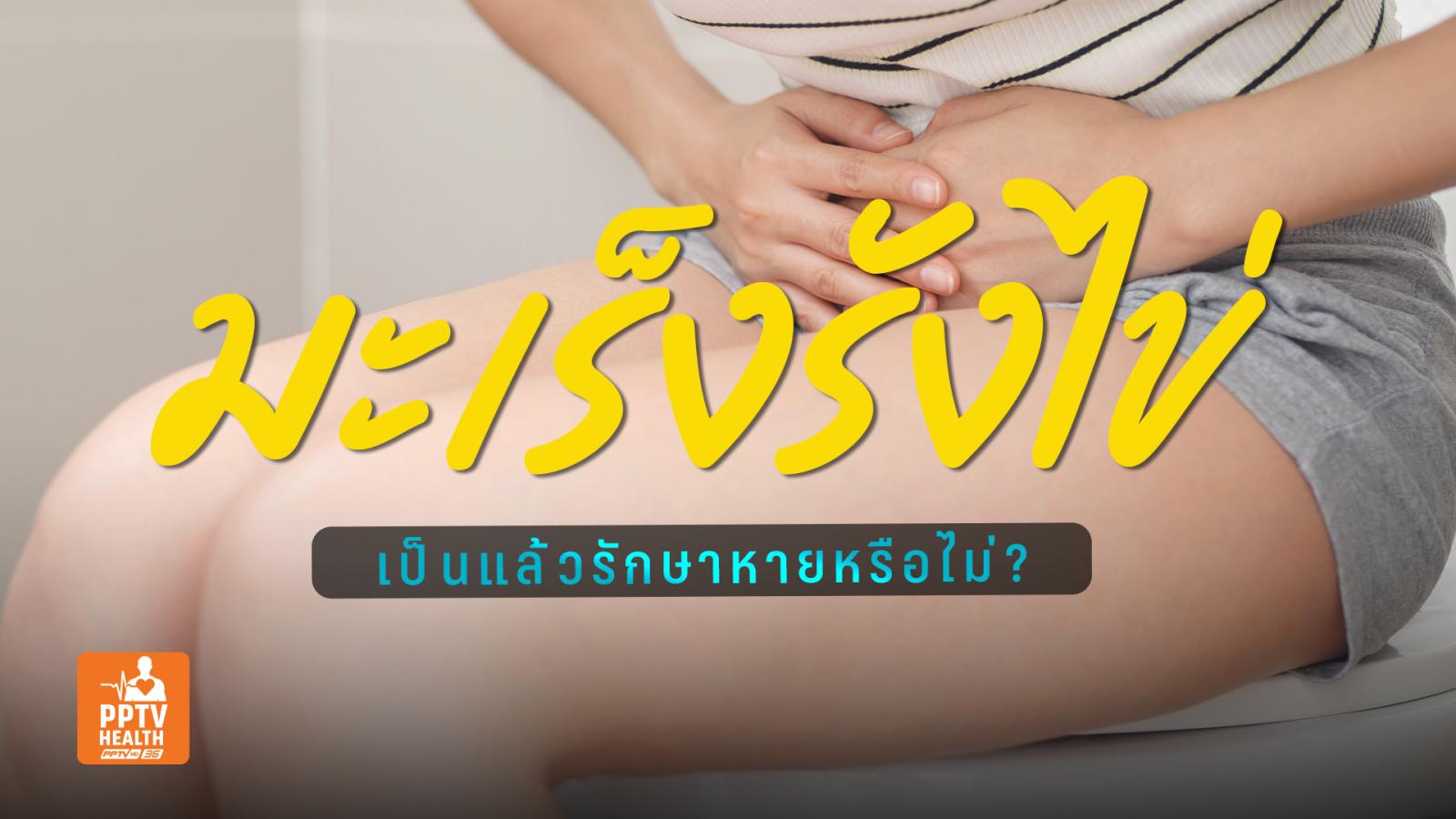 “มะเร็งรังไข่” ลุกลามตั้งแต่ระยะที่ 2 และเทคโนโลยี-วิธีรักษา