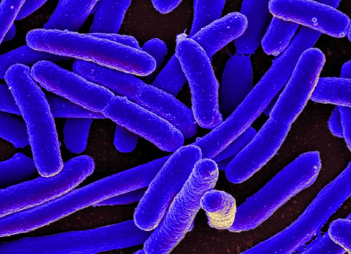 Cientistas conseguem gerar eletricidade a partir da bactéria E. coli – a mesma que causa infecção urinária