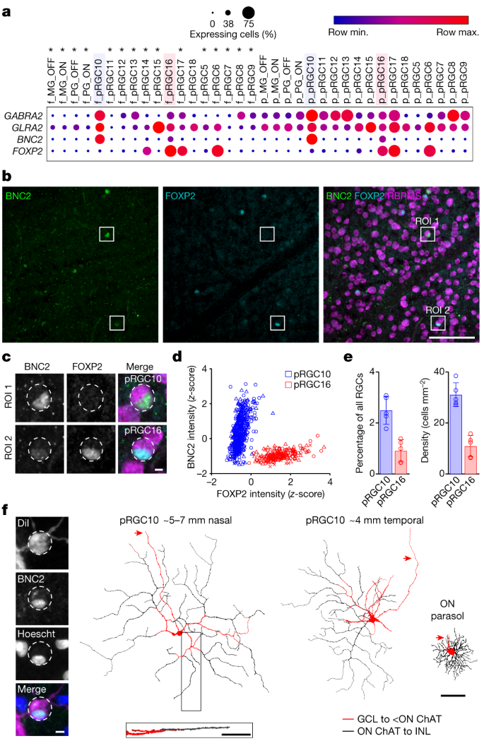 An ON-type direction-selective ganglion cell in primate retina