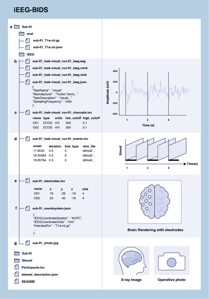 A comparison of neuroelectrophysiology databases