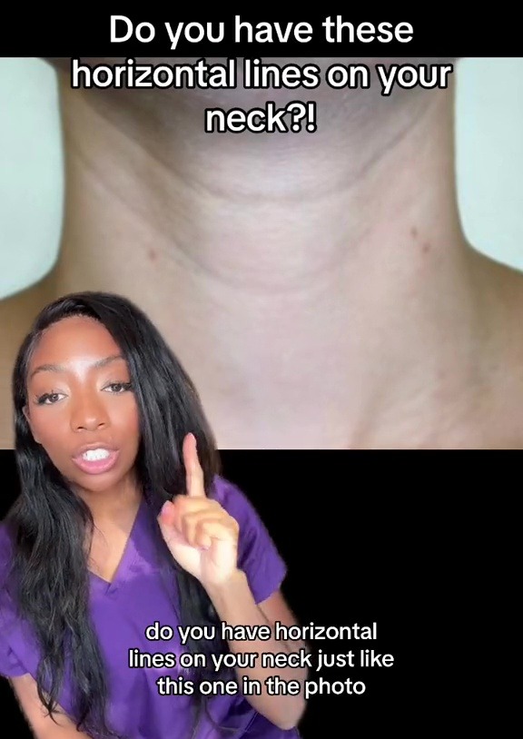 Expert warns about the rise of ‘tech neck’ – here’s how you can fix it