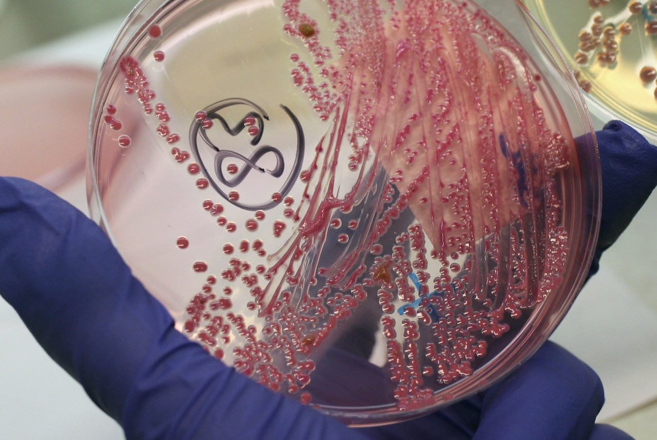 Total children hospitalized after E. coli exposure climbs to 8, health office says