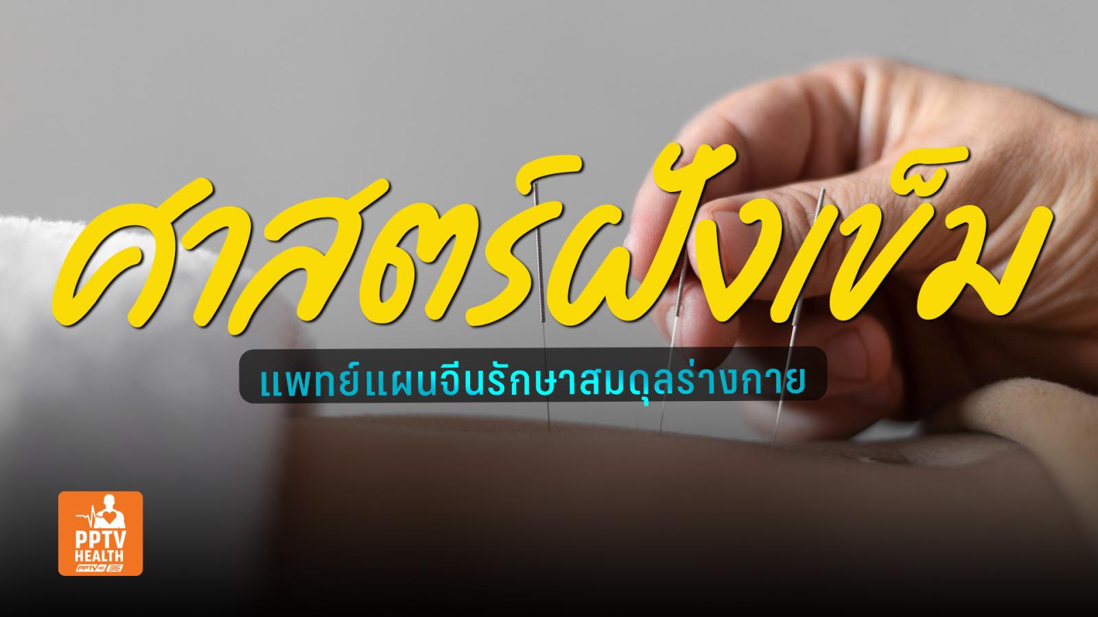 “ฝังเข็ม” ศาสตร์แพทย์แผนจีนที่ WHO รับรองรักษาได้กว่า 100 โรค