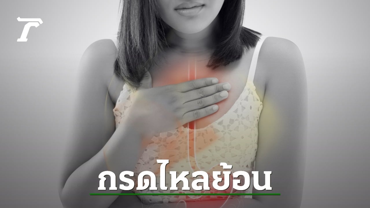 กรดไหลย้อน โรคไม่ร้ายแรง แต่ห้ามปล่อยให้เรื้อรัง