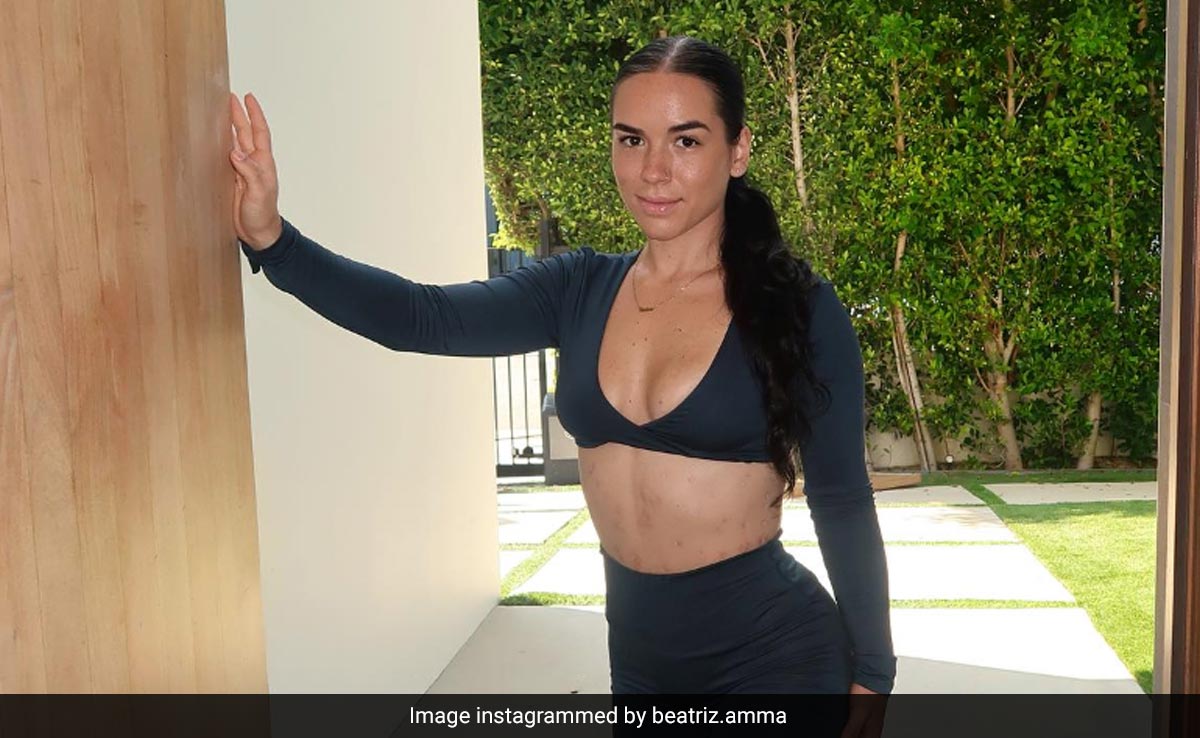 Fitness Influencer Shares Her Body Started Eating Itself After Fat-Dissolving Injections