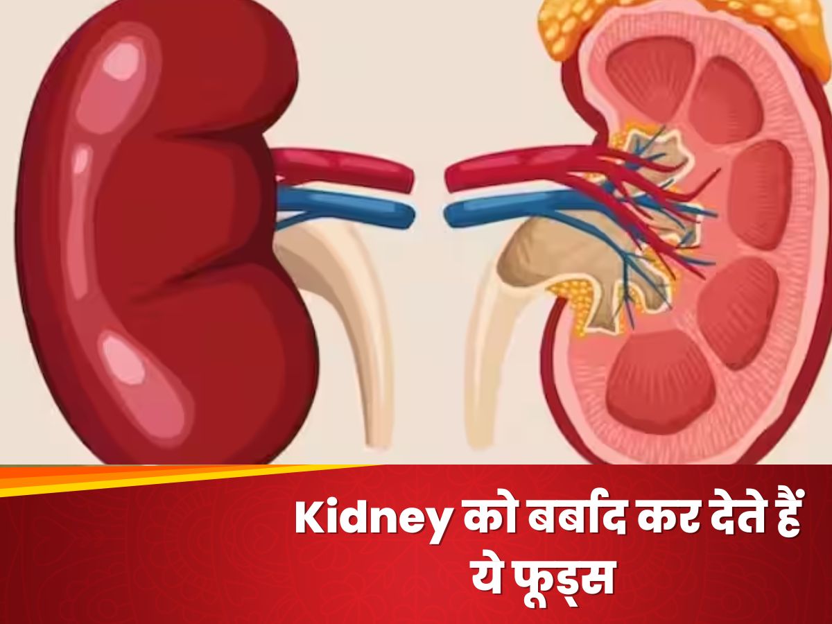 Kidney को बूढ़ा बना देती है ये चीज, आज ही खाने की प्लेट से करें बाहर