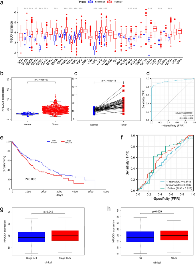 NPLOC4 is a potential target and a poor prognostic signature in lung squamous cell carcinoma