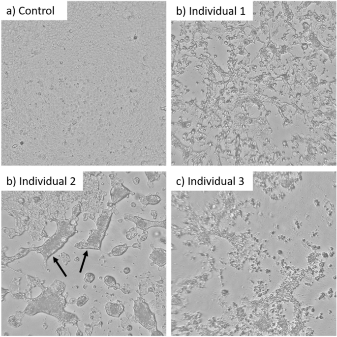 Infectivity of exhaled SARS-CoV-2 aerosols is sufficient to transmit covid-19 within minutes