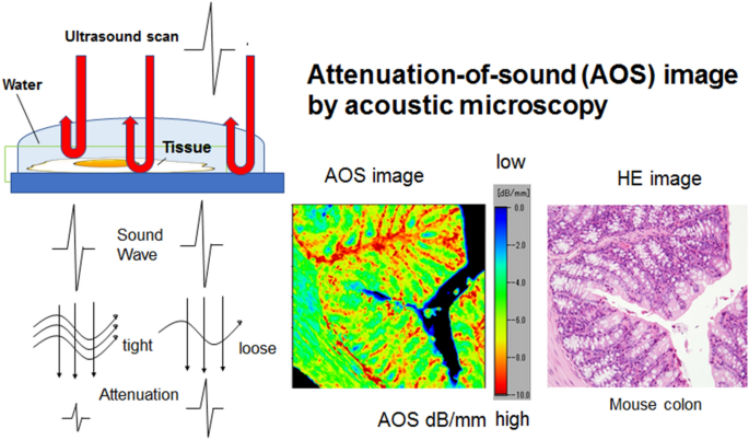 Observations of amyloid breakdown by proteases over time using scanning acoustic microscopy