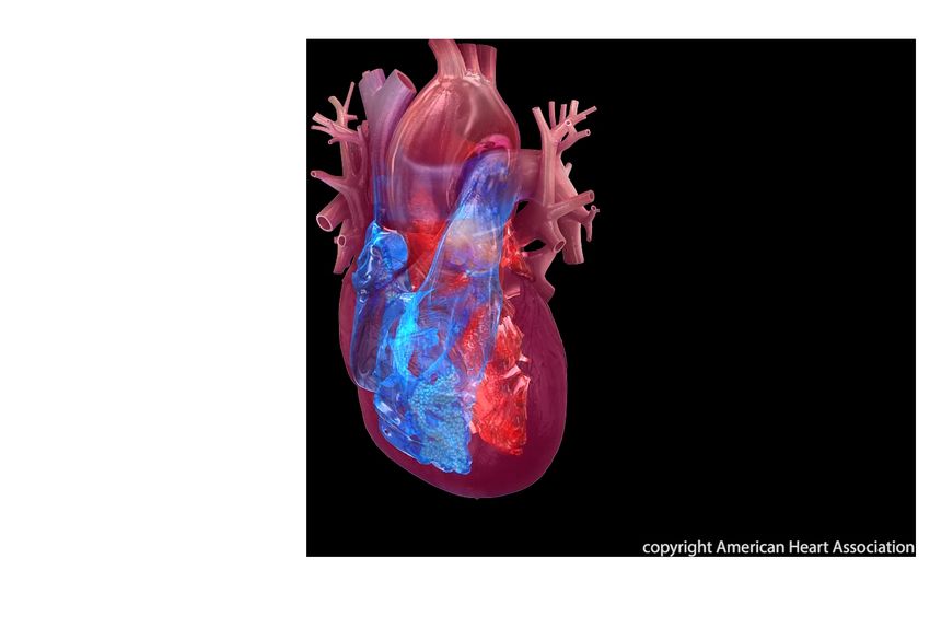 Artificial intelligence may speed heart attack diagnosis and treatment