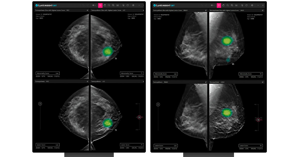 AI roundup: HEALWELL AI buys LLMs, Forward to roll out staffless