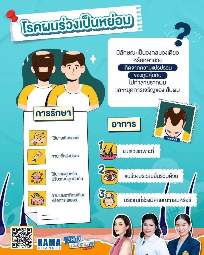 ผมร่วงเป็นหย่อม สูญเสียความมั่นใจ ภาวะใกล้ตัวที่รักษาได้