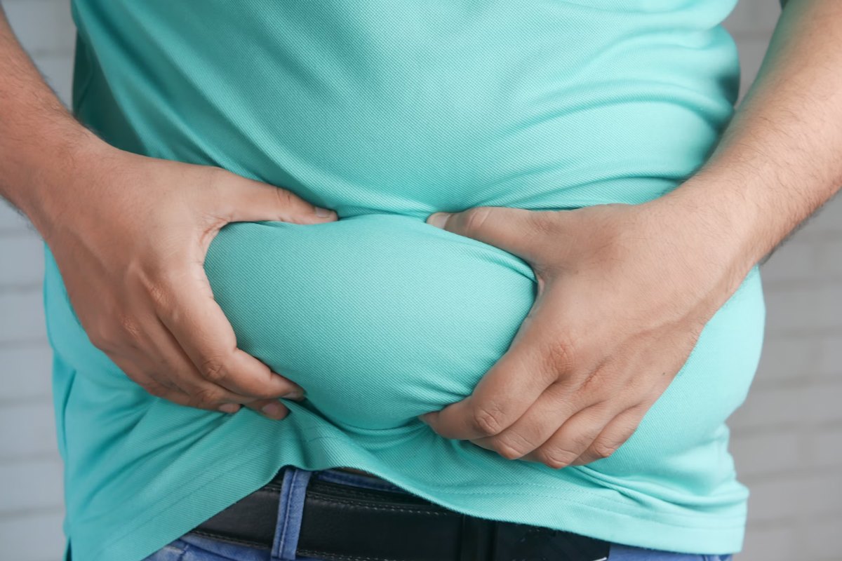 Anti-Obesity Day 2023: Master These Lifestyle Tweaks to Beat Obesity
