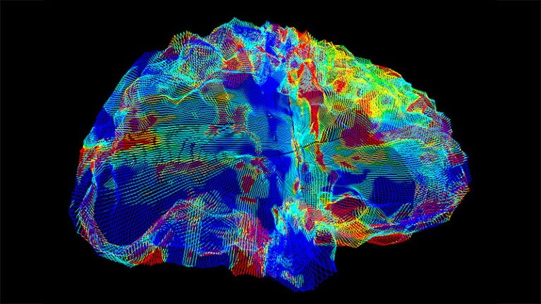 AI that reads brain scans shows promise for finding Alzheimer’s genes