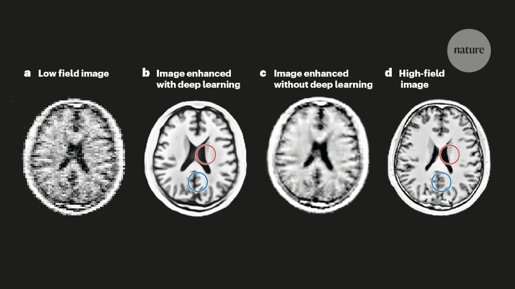 The deep route to low-field MRI with high potential