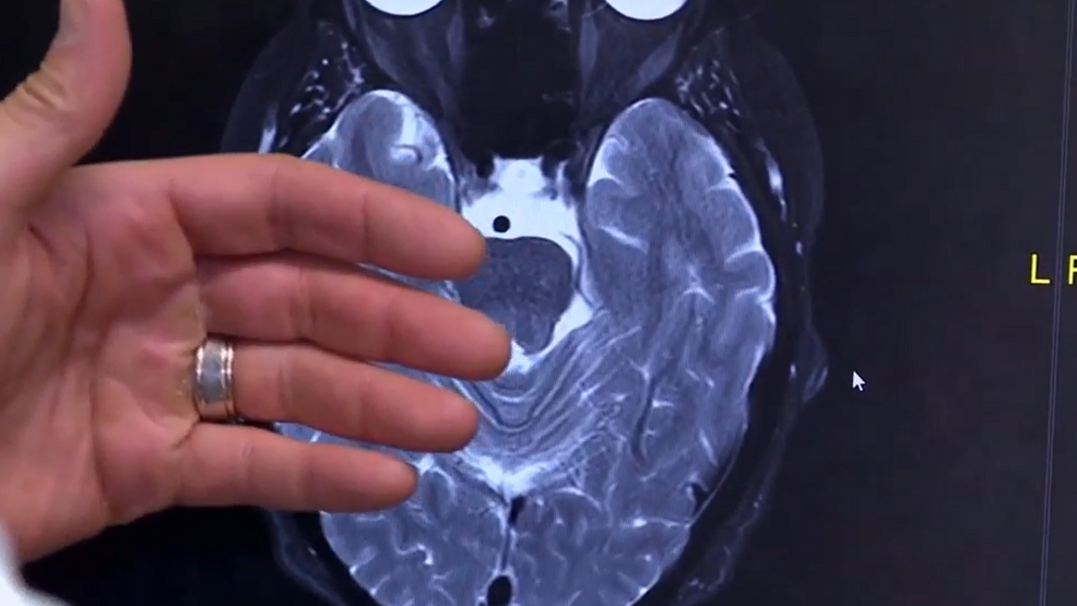 Men’s Health Awareness: mental health, and breaking the stigma