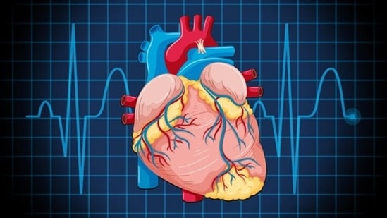 What is dilated cardiomyopathy? Symptoms, causes and treatment of the heart condition