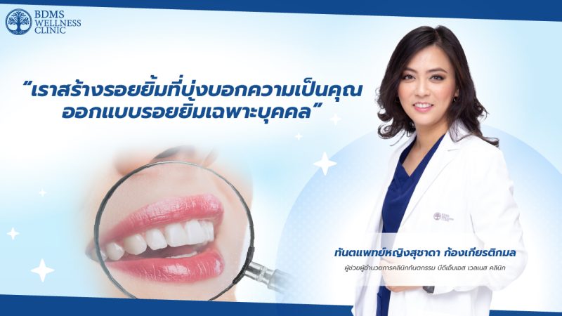 ออกแบบรอยยิ้มด้วยการทำวีเนียร์ เพื่อให้คุณได้มีรอยยิ้มที่เป็นตัวคุณเอง