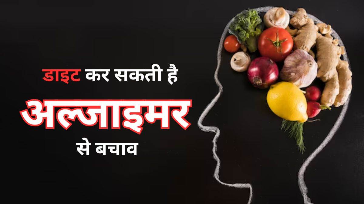 Alzheimer’s: आपका खान-पान कम कर सकता है अल्जाइमर का खतरा, जानें किन फूड आइटम्स से मिलेगी मदद – your diet can lower the risk of Alzheimers know which food items to include in your diet