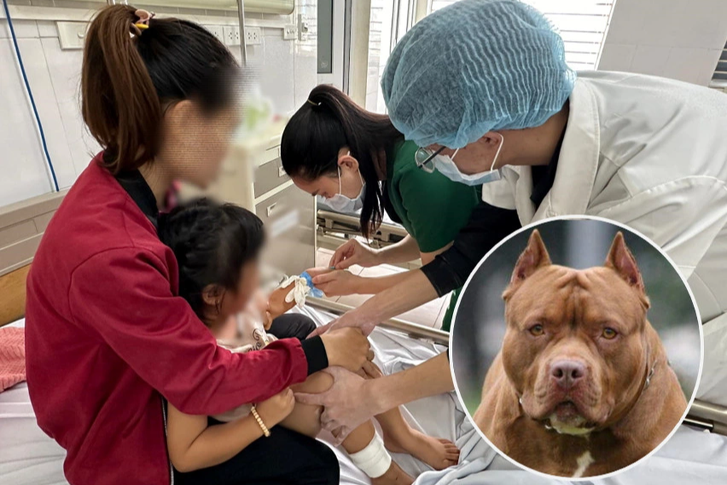 Hà Nội: Bé gái 4 tuổi bị chó Pitbull cắn vào mặt, phải khâu hàng chục mũi