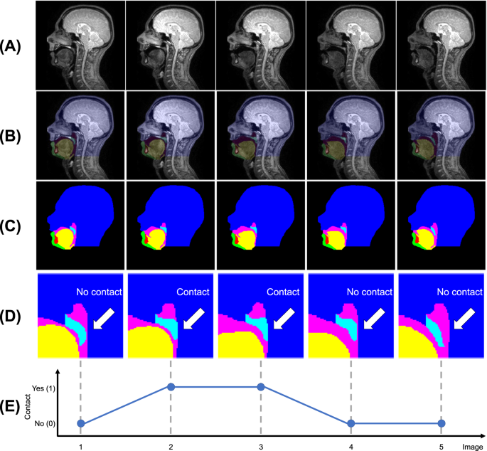 Real-time speech MRI datasets with corresponding articulator ground-truth segmentations