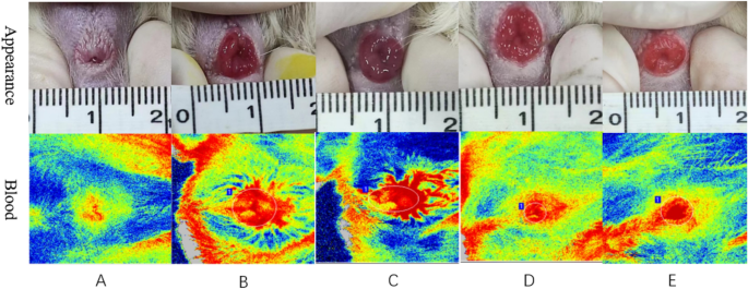 Establishment and study of a rat internal haemorrhoid model