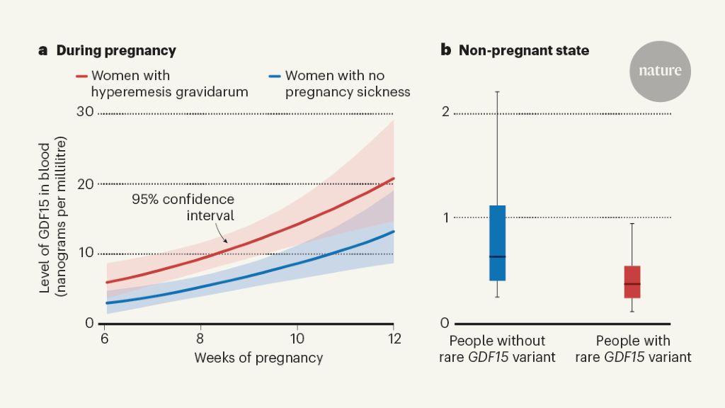 Nausea and vomiting in pregnancy linked to hormone from fetus