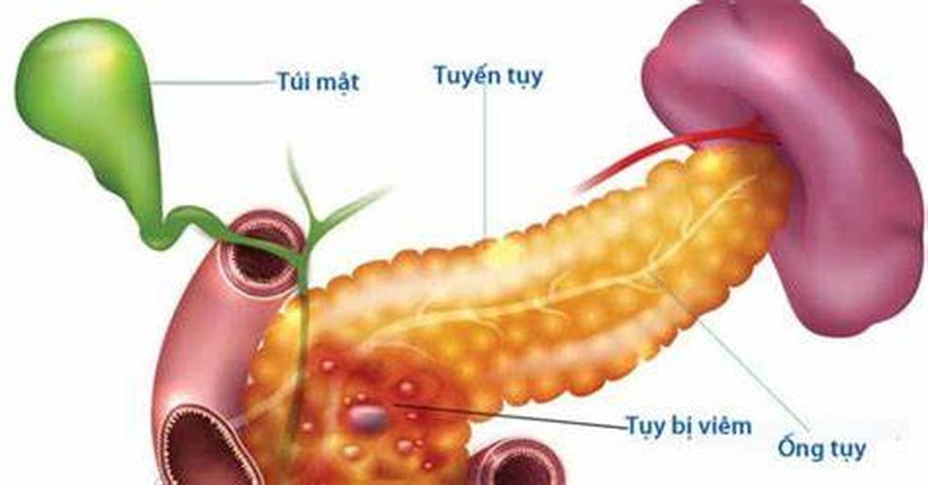 Điều bạn nhất định phải biết khi ăn để bảo vệ tuyến tụy