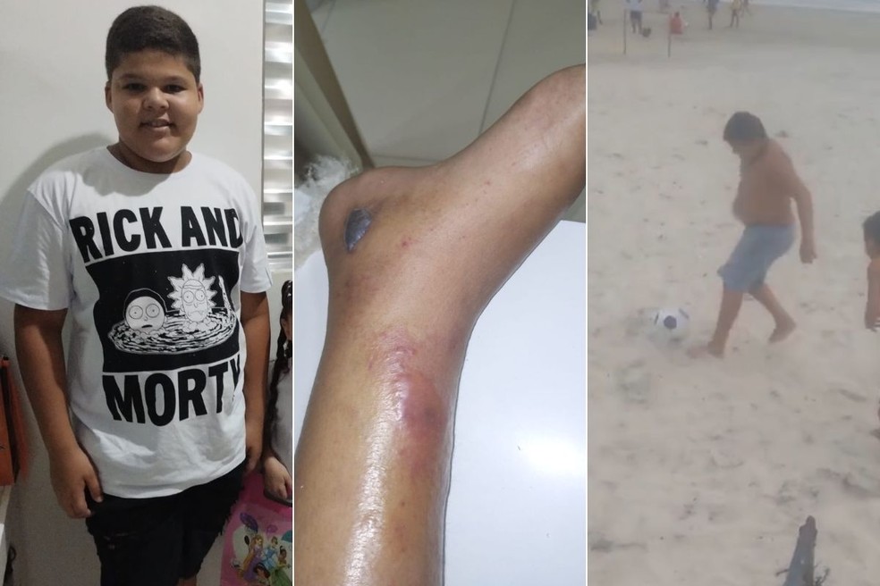 Menino de 12 anos morre após fraturar tornozelo no futebol e família acusa hospitais de negligência: ‘dor e revolta’