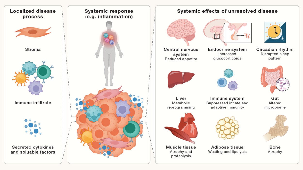 How diet may impact cancer and possible treatments | Cold Spring Harbor Laboratory