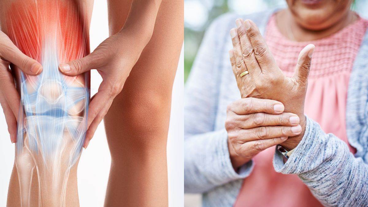 Rheumatoid Arthritis से परेशान हैं तो रोज खाने में जरूर शामिल करें ये फूड आइटम्स – If you are suffering from Rheumatoid Arthritis then definitely include these food items in your daily diet