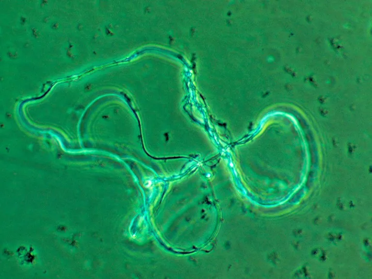 Light micrograph of human DNA.