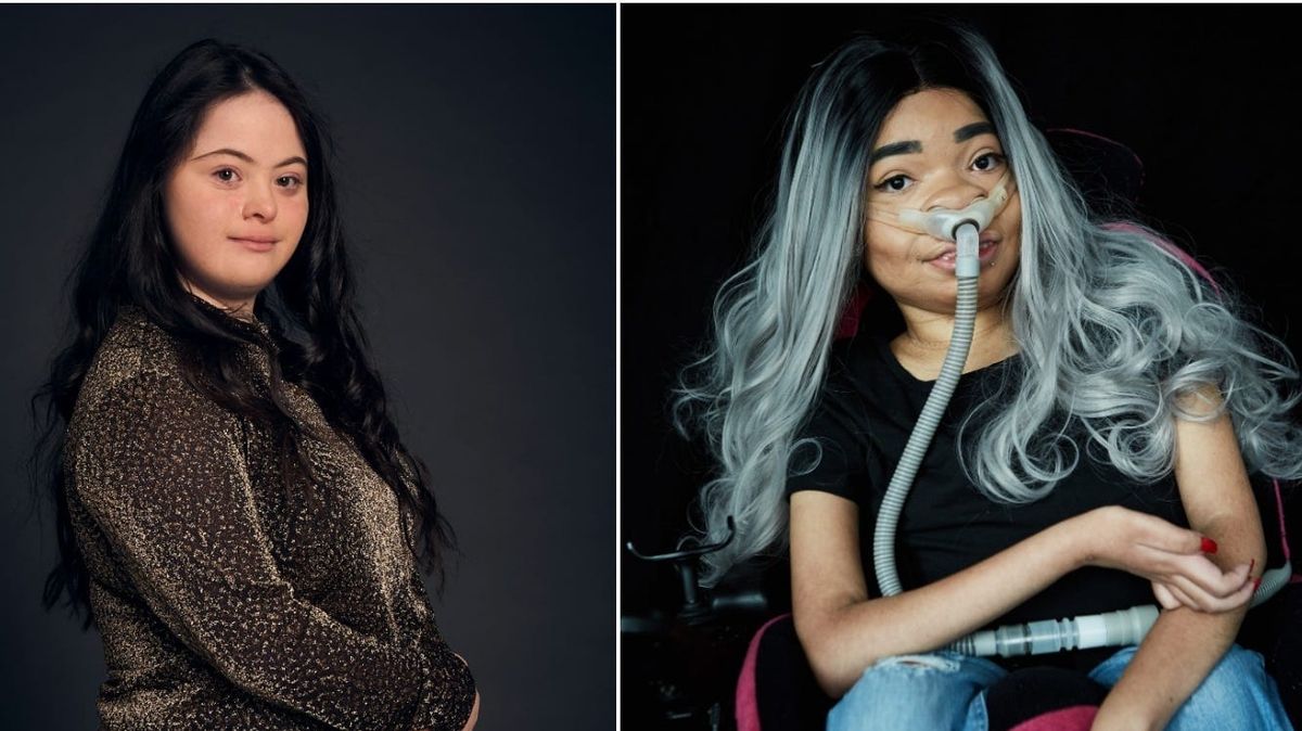 Zebedee Modelling Agency: Redefining Beauty and Championing Inclus…