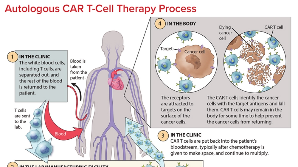 Understanding CAR T-Cell Therapy: Balancing the Risks and Benefits