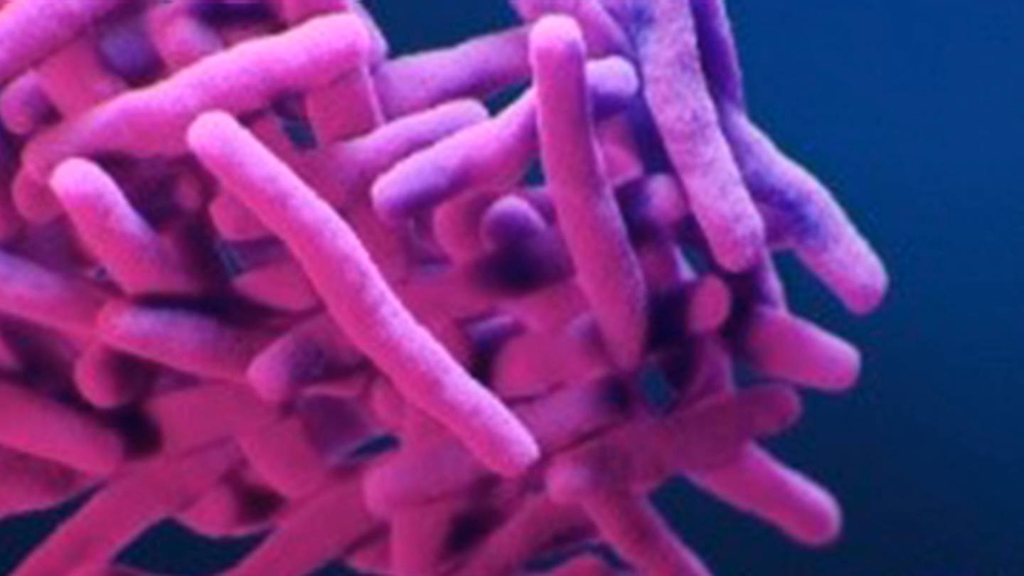 Mass. town says it’s ‘not facing a public health crisis’ amid tuberculosis concerns