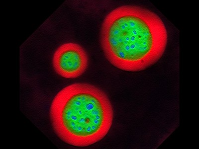 How phase separation is revolutionizing biology