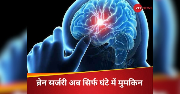 आधे घंटे में दिमाग की सर्जरी करवाएं और काम पर लौट जाएं; ब्रेन ट्यूमर के लिए आई नई टेक्नोलॉजी