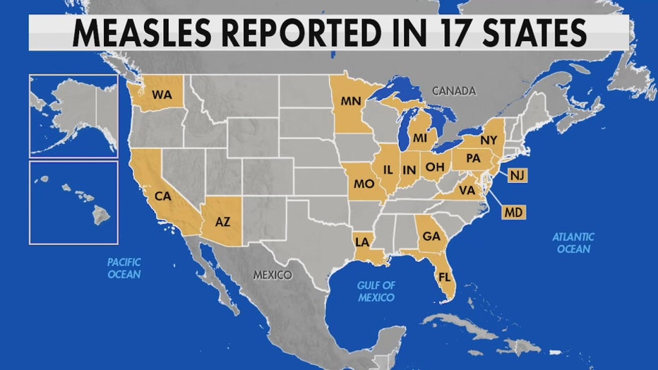 Measles outbreak leads CDC to update travel guidelines