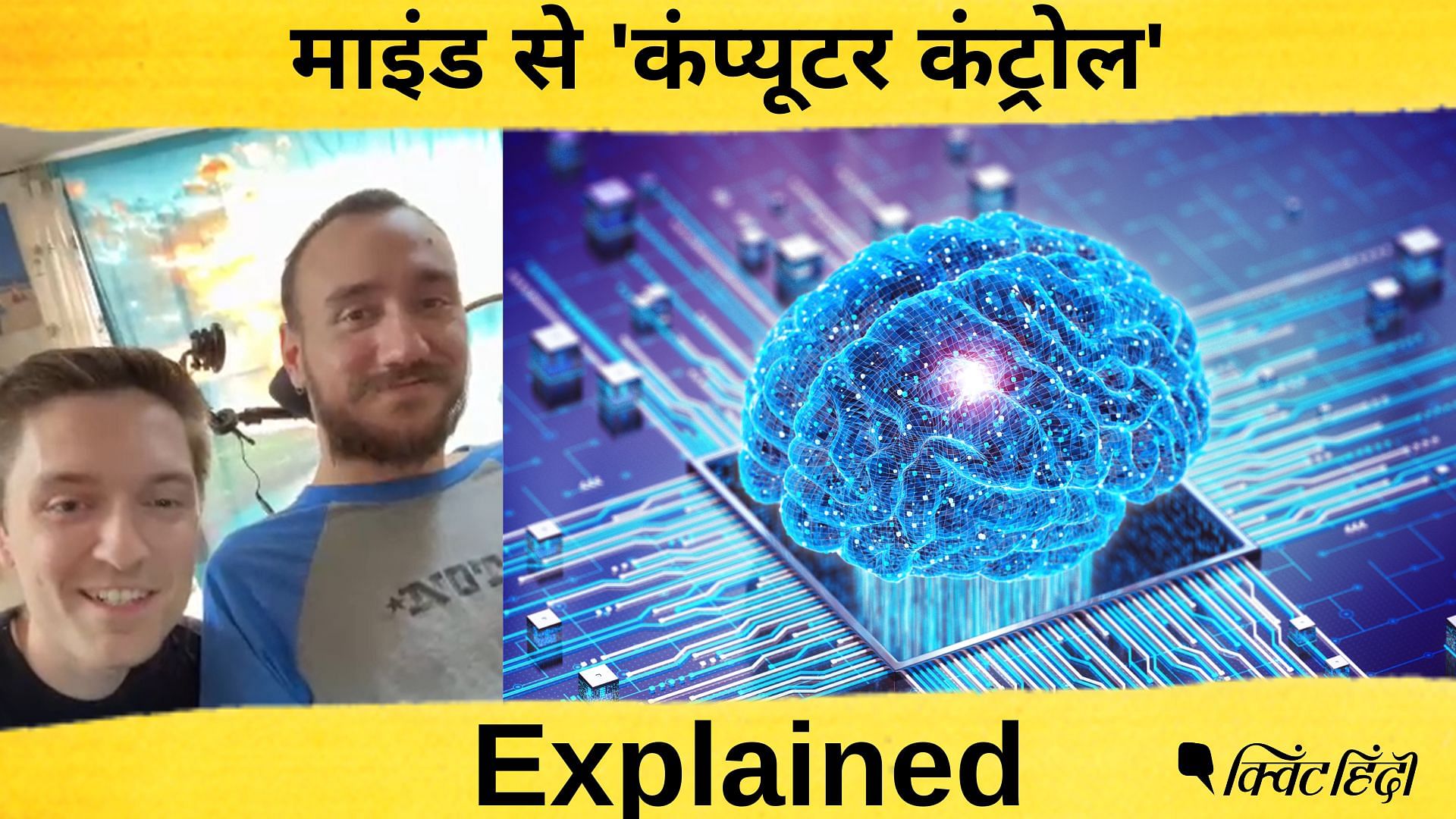 Neuralink: माइंड से कंप्यूटर कैसे होता है ‘कंट्रोल’? एलन मस्क की कंपनी को सफलता| Explained